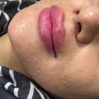 ژل بوتاکس|خدمات آرایشگری و زیبایی|دورود, |دیوار