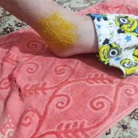 شکسته بندی|خدمات آرایشگری و زیبایی|مشهد, میعاد (شهرک غرب)|دیوار