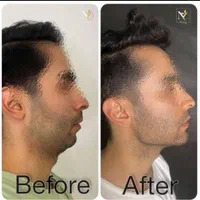 فروش ژل بوتاکس نخ و لوازم بهداشتی کلینیک  زیبایی|خدمات آرایشگری و زیبایی|تهران, قیطریه|دیوار