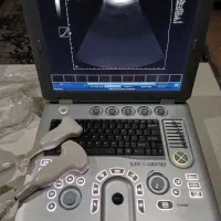 فروش انواع دستگاههای سونوگرافی