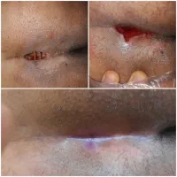 کارشناس تخصصی زخم و استوما|خدمات آرایشگری و زیبایی|قم, زنبیل آباد|دیوار