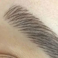 آموزش فیبروز میکروبلیدینگ و میکروپیگمنتیشن و...