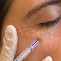 جوانسازی انواع پوست و مو ورفع انواع چین و چروک