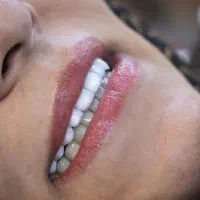 لبخندت رو با ما بدون درد و اقساطی زیباتر کن