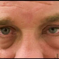 عمل رفع افتادگی پلک / رفع پف زیر چشم|خدمات آرایشگری و زیبایی|خمینی‌شهر, |دیوار