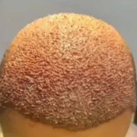کاشت طبیعی مو ،ابرو،ریش،سیبیل|خدمات زیبایی و سلامت|شیراز, زرگری|دیوار