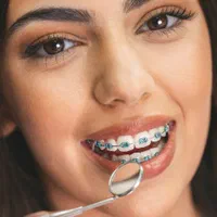 ارتودنسی دندان با ۱۰ م تخفیف/قسطی بی‌ضمانت بی سود|خدمات آرایشگری و زیبایی|شیراز, معالی‌آباد|دیوار