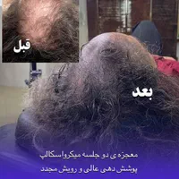خدمات وآموزش اسکالپ و میکرواسکالپ موی سر