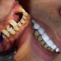 کلینیک دندان پزشکی،کاشت ابرو،ژل|خدمات زیبایی و سلامت|اهواز, کوی ملی راه|دیوار