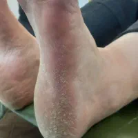 پدیکور و کفسابی (مخصوص بانوان)|خدمات آرایشگری و زیبایی|قزوین, |دیوار