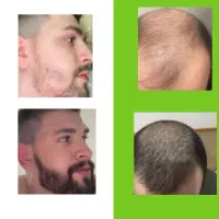 زیبا میشی بابا ناز نکن