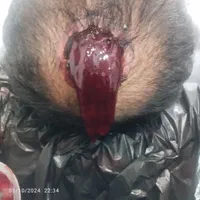 حجامت،زالو‌درمانی، فصدخون،طب سوزنی،مزاج شناسی|خدمات آرایشگری و زیبایی|تهران, بیسیم|دیوار