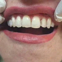 دستیار دندانپزشک