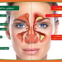 بیماری