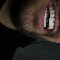 زیبایی|خدمات آرایشگری و زیبایی|گلستان (تهران), |دیوار