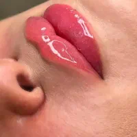 کلینیک تخصصی زیبایی/بوتاکس فیلر لاغری مزو PRP