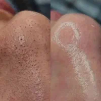 بیوتی رونیکا|خدمات آرایشگری و زیبایی|سراوان, |دیوار