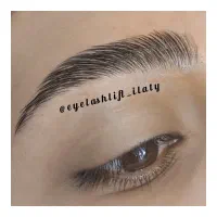 تخفیف ویژه لیفت و لمینت