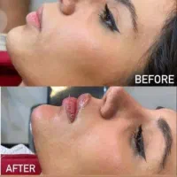 جشنواره ژل و بوتاکس و فیلر بادی و لیفت صورت|خدمات آرایشگری و زیبایی|تهران, صادقیه|دیوار