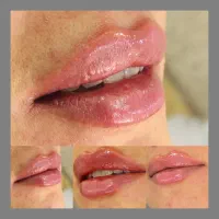 تخفیف ویژه مزوژل ،PRP،بوتاکس|خدمات آرایشگری و زیبایی|شاهینشهر, فردوسی|دیوار