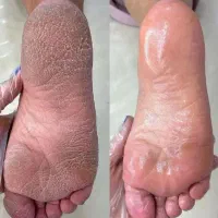 پدیکور آموزش پدیکور نوبهار ژلیش رایگان