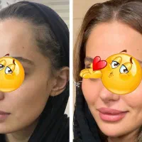 پک چاق کننده صورت و بدن بدون بازگشت و عوارض