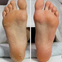 خدمات پدیکور خیس کار درمانی کف سابی