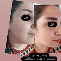 مدل برای پاکسازی پوست برای تکمیل آلبومم