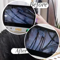 اسکراب‌اسکالپ(پاکسازی کف‌سر)+آنالیز ومشاوره رایگان|خدمات آرایشگری و زیبایی|کرج, باغستان|دیوار