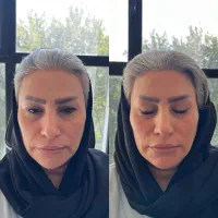 جشنواره تخفیفهای تابستانی کلینیک زیبایی ساری