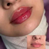 فیلر بادی ژل بادی هیپ دیپ فرم دهی و لیفت..