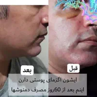 روغن های اصل برای پوست|آرایشی، بهداشتی، درمانی|اصفهان, ملاصدرا|دیوار