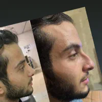 جراحی بینی عالی وهزاران جراحی بینی ترمیم شده موفق|خدمات زیبایی و سلامت|تهران, حسنآباد|دیوار