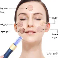 پلاسماجت،میکرونیدلینگ،خالبرداری،آموزش