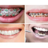 ایمپلنت مهر شفاء|خدمات آرایشگری و زیبایی|قم, حنیف نژاد|دیوار