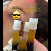 جشنواره تخفیف ویژه تزریق ژل و بوتاکس|خدمات آرایشگری و زیبایی|اصفهان, بوستان آینه خانه|دیوار