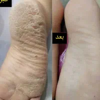 پدیکور و پارافین تراپی و اموزش پدیکور|خدمات آرایشگری و زیبایی|اهواز, زیتون کارگری|دیوار