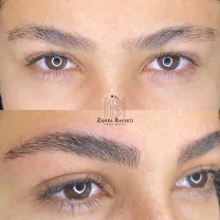 میکرو بلیدینگ