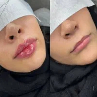 جشنواره تخفیفات کلینیک پزشکی زیبایی بوتاکس و فیلر|خدمات آرایشگری و زیبایی|شیراز, ارم|دیوار