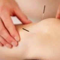 تمامی خدمات حجامت فصد طب سوزنی لاغری حجم دهی|خدمات آرایشگری و زیبایی|مشهد, شهرک مهر آباد|دیوار