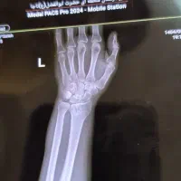 استخدام تایپیست حرفه ای