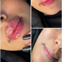 تزریق ژل وبوتاکس|خدمات آرایشگری و زیبایی|قم, بکایی|دیوار