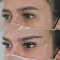 مطب‌دکترژل وبوتاکس.افزایش سایزآلت آقایان.لیفت بانخ|خدمات آرایشگری و زیبایی|قم, صفائیه|دیوار
