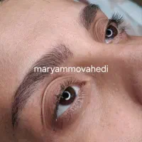 مدل برای فیبروز ابرو