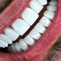 دندانپزشک ایمپلنت و دندانپزشک زیبایی و یک عمومی.