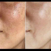 بمب ضدلک و روشن کننده