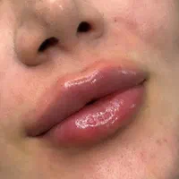 ژل و بوتاکس کلینیک زیبایی دکترفرشیدکریمی|خدمات آرایشگری و زیبایی|کرمانشاه, |دیوار