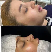 اولین مرکز مجرب زیبایی