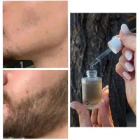 ۱ ماهه ریش در بیار