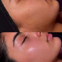 آموزش درما پلنینگ و اصلاح تخصصی|خدمات آموزشی|بیرجند, |دیوار